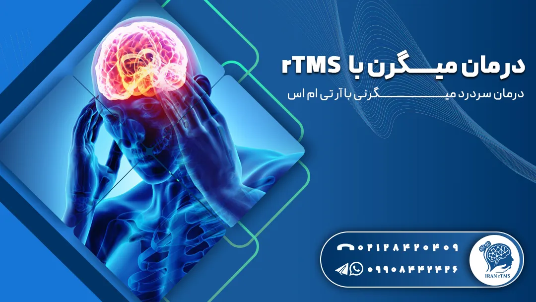 وکتور درمان میگرن با rTMS