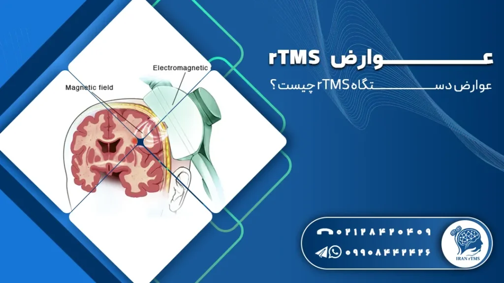 وکتور مغر و ار تی ام اس و توضیح عوارض rTMS