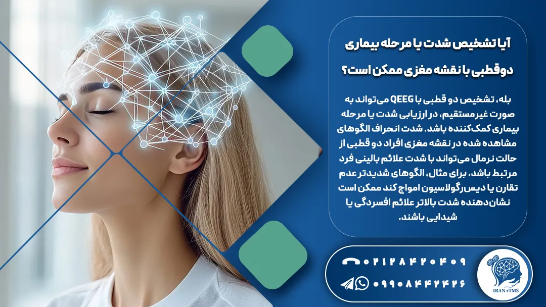 وکتور ار تی ام اس آیا تشخیص شدت یا مرحله بیماری دوقطبی با نقشه مغزی ممکن است؟