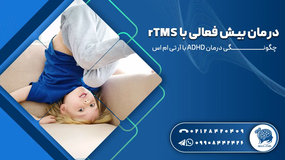 درمان بیش فعالی با rTMS