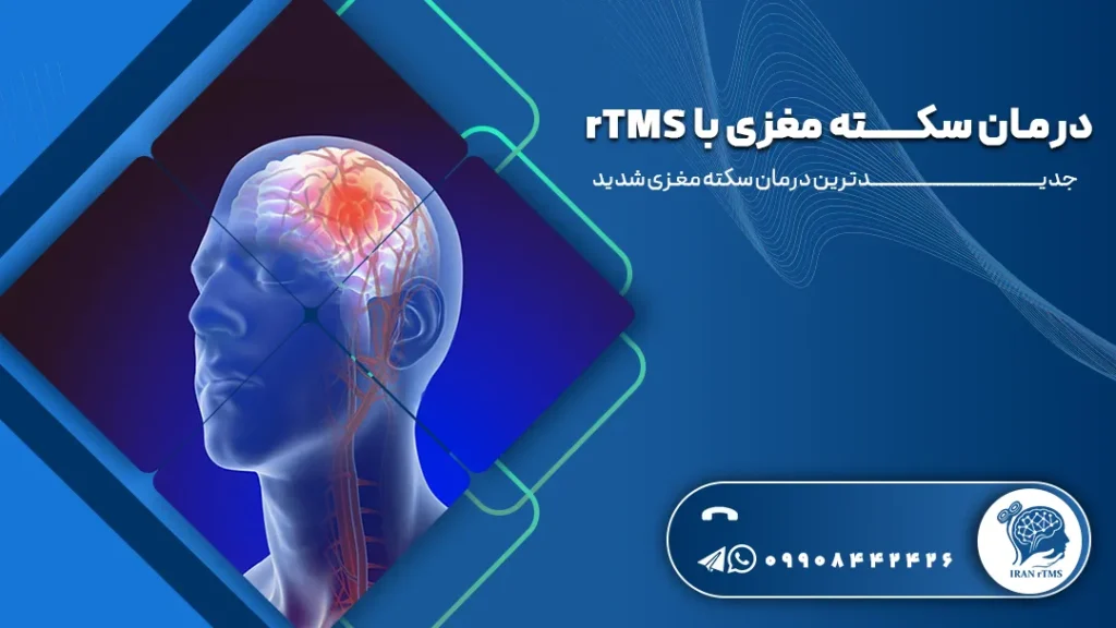 وکتور درمان سکته مغزی با rTMS