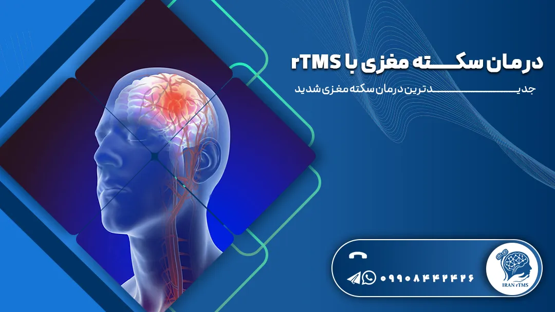 وکتور درمان سکته مغزی با rTMS
