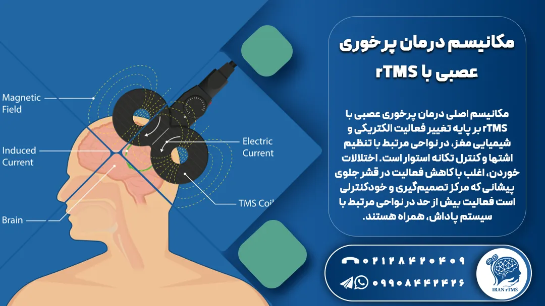 توضیح مکانیسم درمان پرخوری عصبی با rTMS