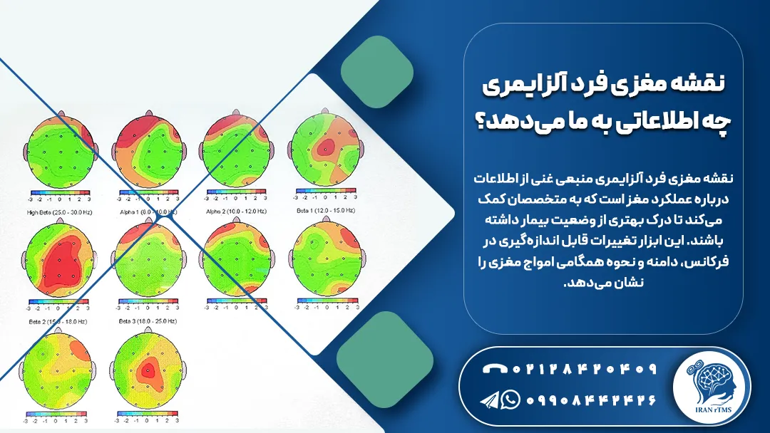 نقشه مغزی فرد آلزایمری