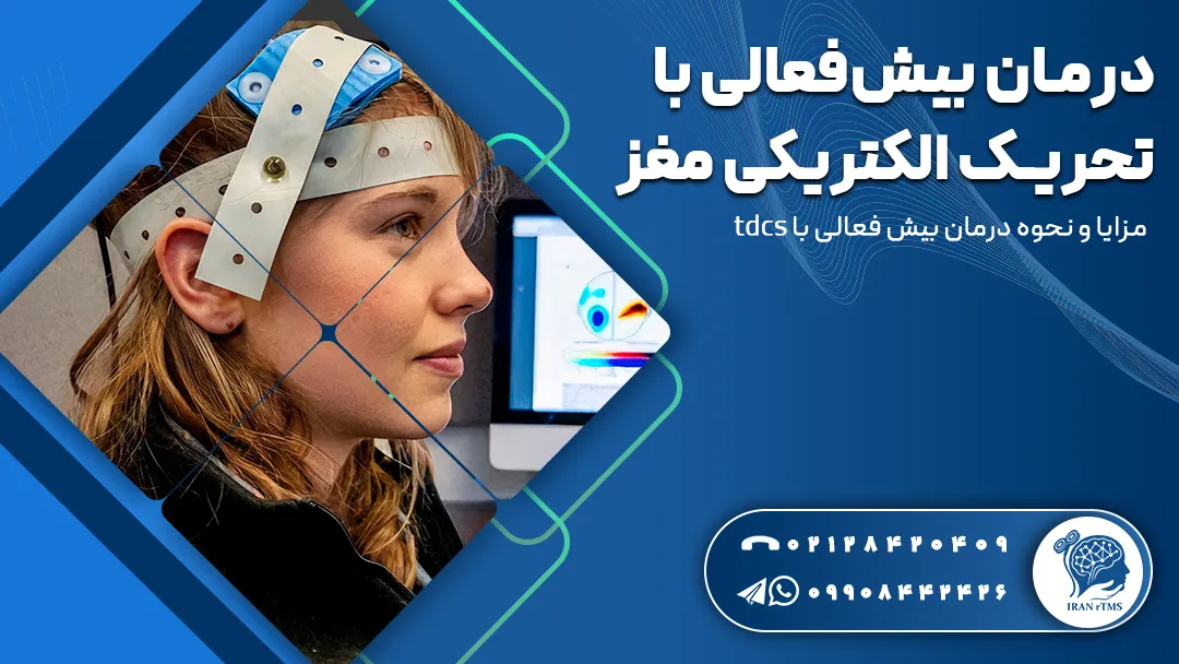 کلاه الکترود روی سر بیمار برای درمان بیش فعالی با تحریک الکتریکی مغز