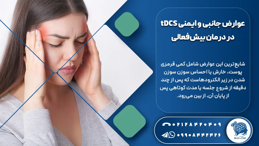 دختر جوان که سردرد دارد یکی از عوارض جانبی و ایمنی tDCS در درمان بیش‌فعالی