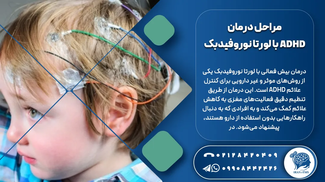 کودکی که الکترودهای لورتانوروفیدبک روی سرش قرار گرفته برای درمان بیش فعالی