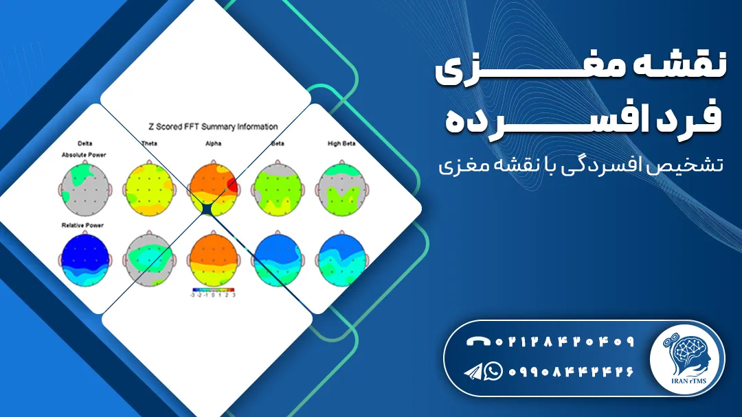 نقشه مغزی فرد افسرده