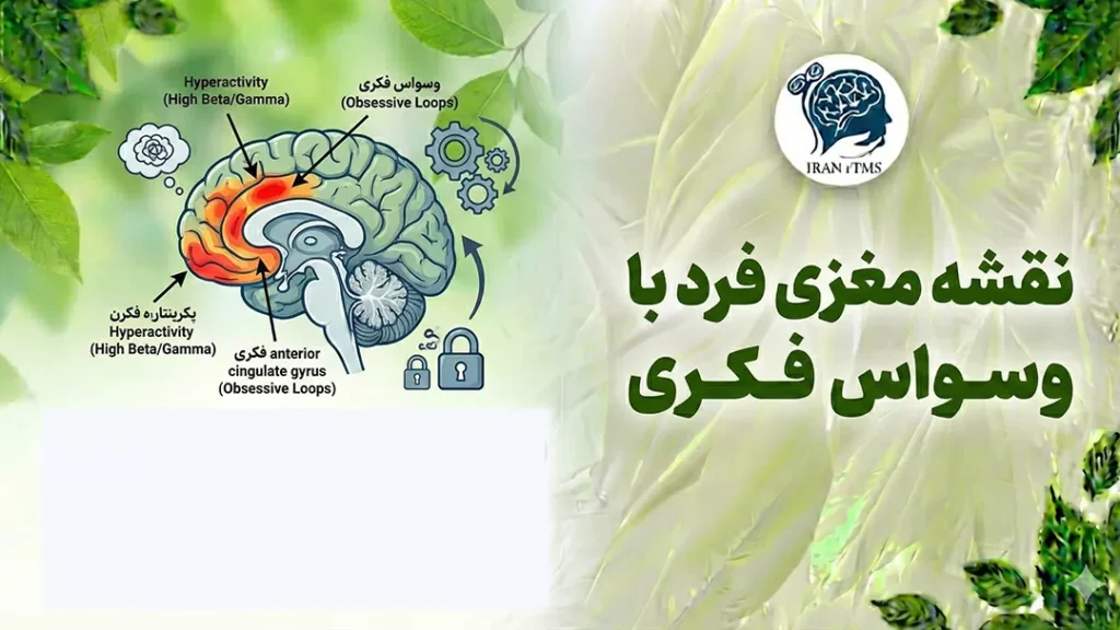 نقشه مغزی وسواس