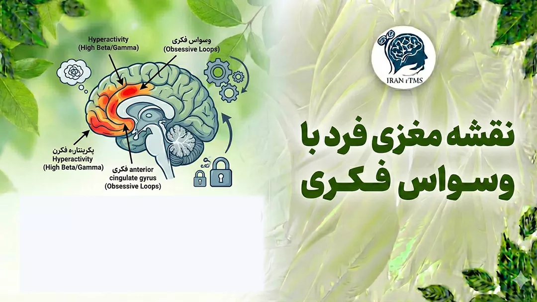 نقشه مغزی وسواس